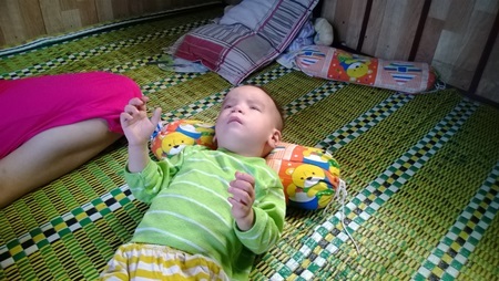 Đắng lòng bé trai 22 tháng tuổi bị đục thủy tinh thể, tim bẩm sinh - 2 Cháu Minh Quang bị đục thủy tinh thể và tim bẩm sinh