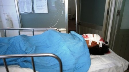 Bệnh nhân đã được phẫu thuật thành công