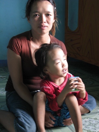 Bé 3 tuổi đã mắt mờ, tai điếc kèm tim bẩm sinh