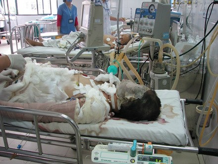 Vụ tưới xăng thiêu bạn gái: Nạn nhân khó qua khỏi - 2 Nạn nhân được tiên lượng tử vong gần