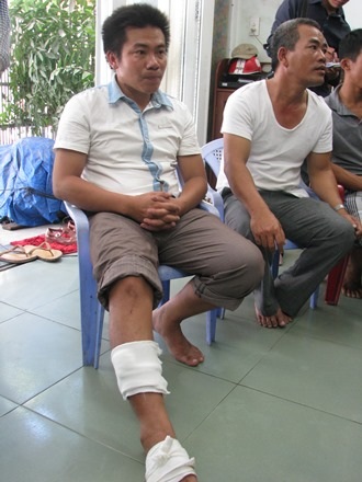 Ngư dân Nguyễn Huỳnh Bá Biên bị thương ở chân