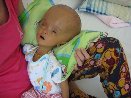 Cháu Gia Long khi còn sống 