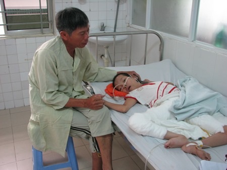 Ông Diện lo lắng không biết lấy đâu ra tiền để ghép da nhân tạo cho con