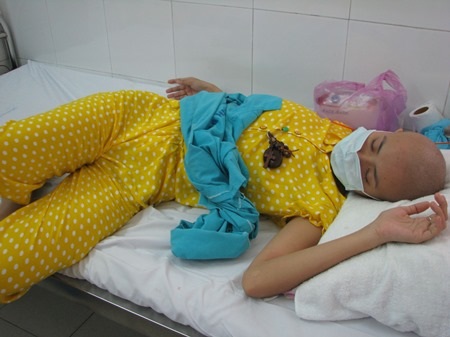 Để giành lại sự sống, Nữ cần được ghép tủy