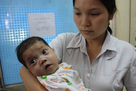 Vẫn chưa có bệnh viện nào nhận phẫu thuật tim cho bé Trà My - 1