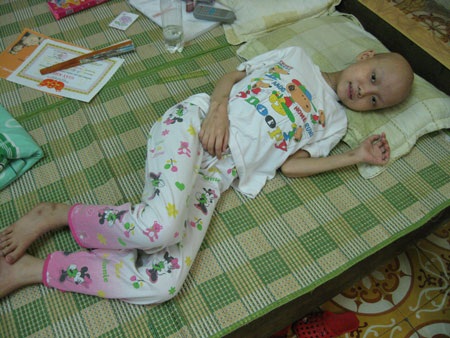 Những tháng ngày buồn của cô bé 8 tuổi sắp lìa xa cõi đời - 2 Những tháng ngày buồn của cô bé 8 tuổi sắp lìa xa cõi đời - 2