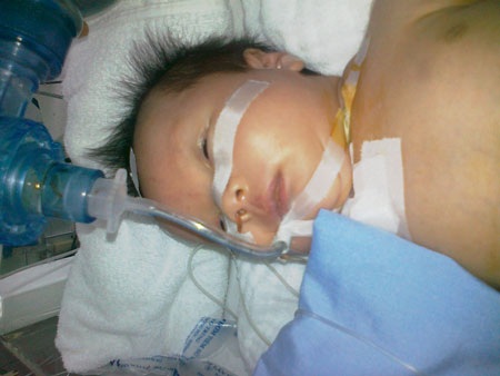 Bé 20 ngày tuổi suýt tử vong khi điều trị bệnh vàng da - 1