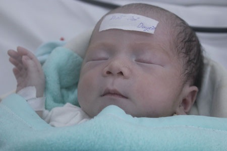 và sau khi được cấy máy tạo nhịp tim