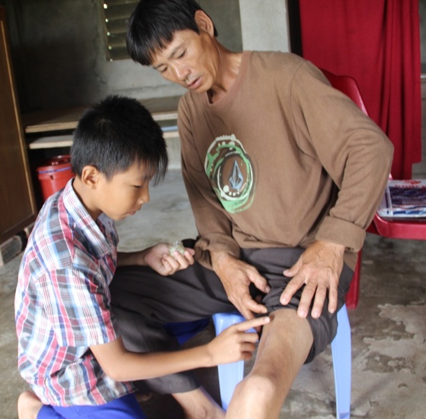 
Thời tiết thay đổi khiến chân anh Quyền bị tê cứng, không cử động được
