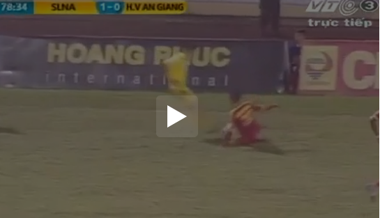 Bị gãy xương ống chân, cầu thủ của HV.An Giang phải nghỉ nguyên mùa