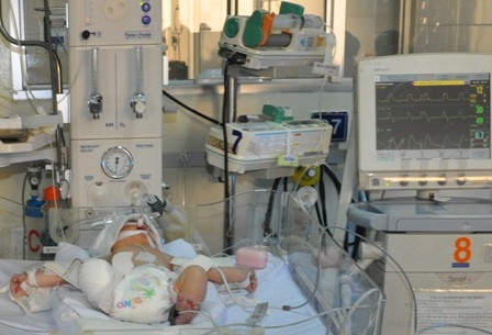 BS cho bệnh nhi thở máy trở lại để hạn chế mọi rủi ro có thể ảnh hưởng đến bé