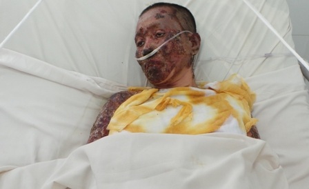 Ánh mắt khắc khoải trong vô vọng của người đàn bà khốn khổ