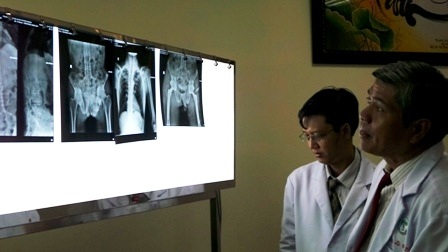 Ca gây mê, phẫu thuật thay khớp cho bệnh nhân đã được thực hiện thành công