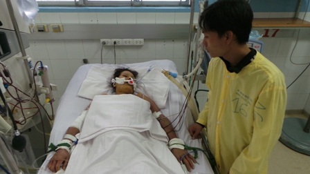 Một trường hợp sốt xuất huyết điều trị tại bệnh viện Bệnh Nhiệt Đới