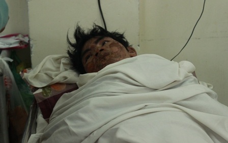 Mới làm việc chưa được 1 tuần, tai nạn đã ập đến với chàng trai trẻ