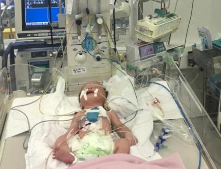 Bệnh nhi đang được hồi sức tại Nhi Đồng 2