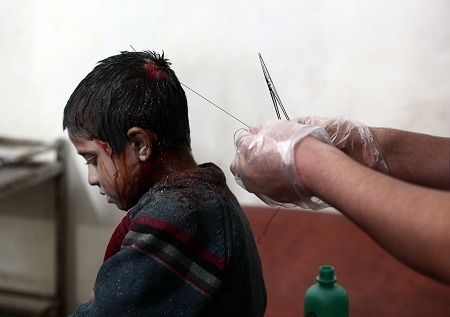 Những bức ảnh kể câu chuyện về thế giới năm 2014