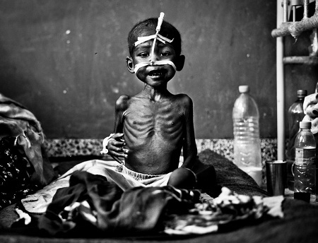 Việt Nam trong bộ ảnh “Sự đói nghèo và niềm hy vọng” của Mỹ - 17 Somalia: