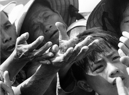 Đau thương chiến tranh qua những bàn tay - 8 Đôi bàn tay nghèo khó,
đói khổ, bệnh tật…