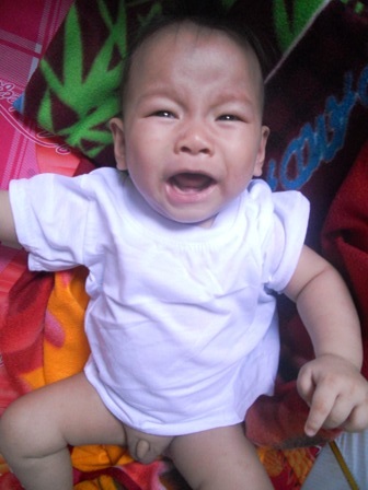 Cháu bé 8 tháng tuổi mang trong mình nhiều loại bệnh