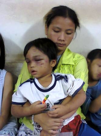 Cháu bé 3 tuổi bị bạo hành được mẹ đưa đi trốn? - 1 Cháu bé 3 tuổi bị bạo hành được mẹ đưa đi trốn?