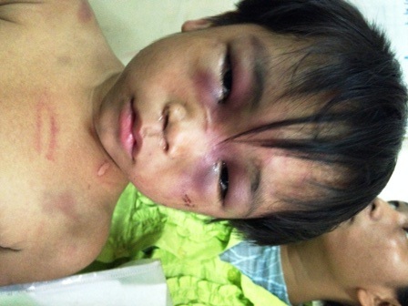 Cháu Đức đã bị mẹ đưa đi đâu không rõ