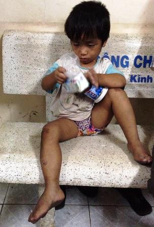 Giải cứu thành công cháu bé 3 tuổi bị ép đi ăn xin, bạo hành - 2 Mọi món ăn, thức uống của những đứa trẻ bình thường khác, với cháu Đức dường như đều xa lạ...