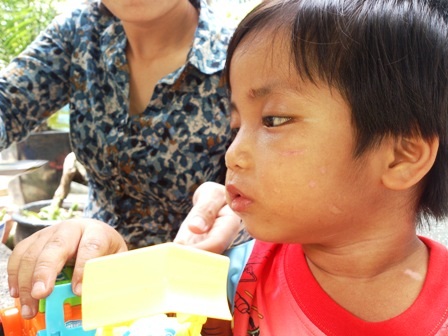 Bừng sáng nụ cười trên gương mặt cháu bé 3 tuổi bị bạo hành - 7 Những vết thương trên cơ thể non nớt đã lành lặn