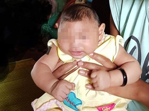 Việt Nam xác nhận ca mắc hội chứng đầu nhỏ do vi rút Zika đầu tiên - 1 Bé gái 4 tháng tuổi ở Đắk Lắk là ca mắc hội chứng đầu nhỏ do vi rút Zika đầu tiên tại Việt Nam. Ảnh: VTC