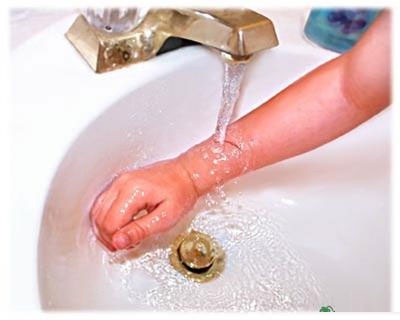 Các nguyên tắc không thể bỏ qua khi sơ cứu bỏng - 1 Ngâm vùng bỏng vào nước, hoặc cho vùng bỏng vào vòi nước đang chảy là cách sơ cứu đúng, khoa học nhất giúp hạ nhiệt tại vùng da bị bỏng, giảm bỏng sâu.