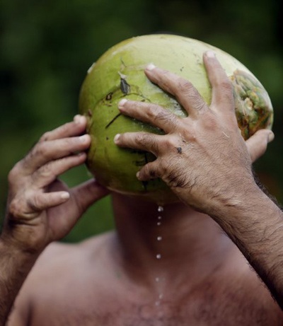 Người đàn ông sở hữu 24 ngón chân tay hoàn hảo - 2