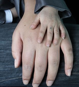 Người khổng lồ và chàng tí hon - 7 Người khổng lồ và chàng tí hon - 7