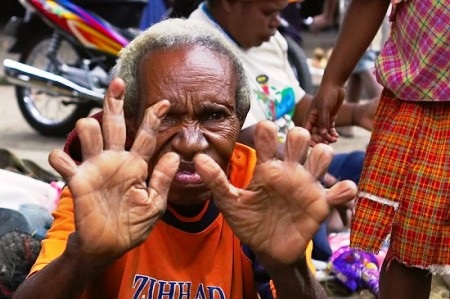 Cắt cụt ngón tay để thể hiện lòng xót thương với người chết - 1