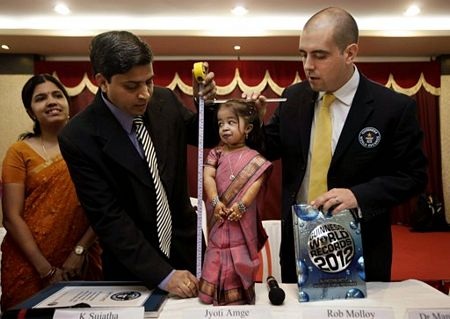 Cô gái 18 tuổi cao chưa đầy 63 cm - 1