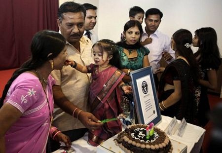 Cô gái 18 tuổi cao chưa đầy 63 cm - 15