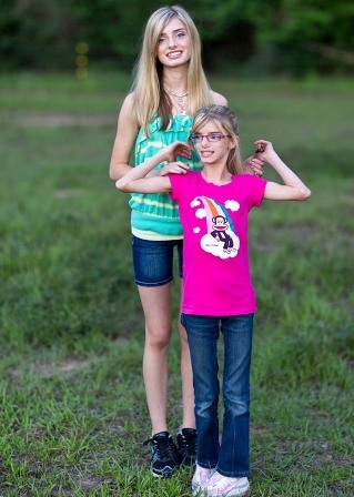 Cặp song sinh dị biệt nhất thế giới - 1 Cặp song sinh dị biệt nhất thế giới - 1