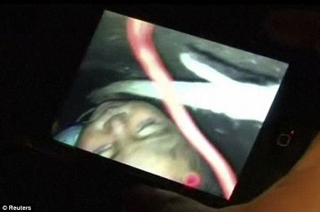 Giải cứu em bé bị rơi xuống giếng sâu 12m