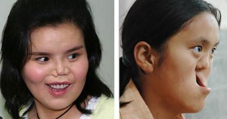 Trung Quốc tái tạo thành công khuôn mặt “quái vật” - 1 Trung Quốc tái tạo thành công khuôn mặt “quái vật”