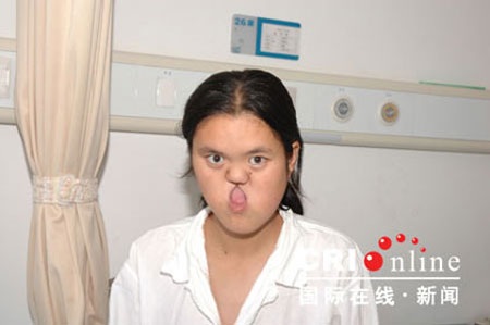 Trung Quốc tái tạo thành công khuôn mặt “quái vật” - 2 Trung Quốc tái tạo thành công khuôn mặt “quái vật”