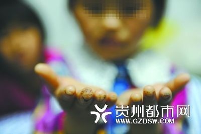 Hai bé gái Trung Quốc bị bỏ đói đến chết - 1 Hàng loạt vụ ngược đãi trẻ em xảy ra gần đây đã khiến người dân Trung Quốc bị sốc. (Ảnh minh họa)