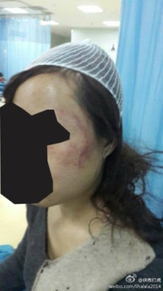 Phó hiệu trưởng trường đảng Trung Quốc bị tung ảnh "nóng" - 3 Người phụ nữ giấu tên đã bị ông Qin và vợ ông đánh đập.