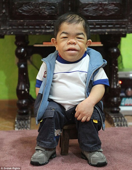 Anh chàng cao gần 70 cm mơ tìm bạn gái - 4 Nơi Edward ở là một trong những vùng nghèo nhất Comlombia.