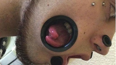 Nghệ sĩ "body art" gây sốc với lưỡi chẻ đôi có thể thò qua má! - 1 Lỗ trên má gớm ghiếc của Miggler (Nguồn: Metro)