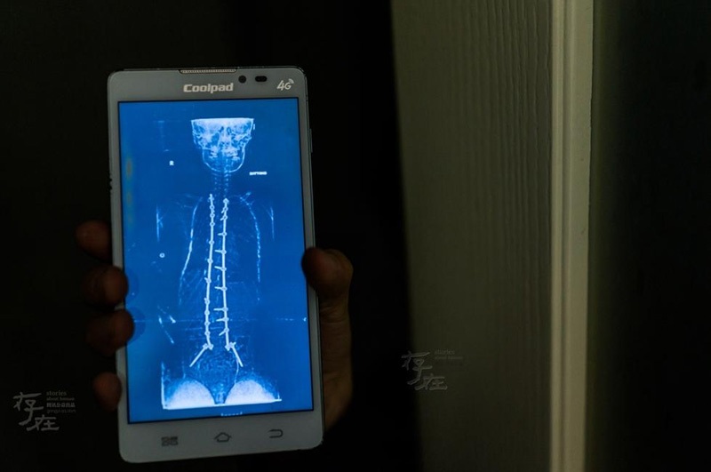 Cậu bé 11 tuổi liệt toàn thân giành HCV Toán học trẻ quốc tế - 3 Cậu bé 11 tuổi liệt toàn thân giành HCV Toán học trẻ quốc tế