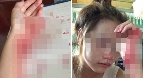 Lột đồ, rạch tay, tự tử - Những hành động gây “sốc” khó hiểu của bạn trẻ - 3 Lý do tự làm đau mình được đưa ra: Oán hận hoặc nhớ nhung người yêu.