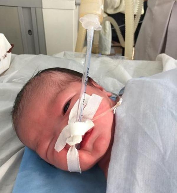 Vụ sản phụ tử vong ở Bình Định: Người thân tố bác sĩ tắc trách? - 2 Cháu bé con sản phụ L. dù được mổ cấp cứu nhưng hiện sức khỏe đang nguy kịch đang phải thở máy