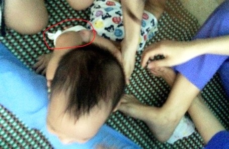 Đóng cửa cơ sở Mầm non Sơn Ca, hơn 70 trẻ chuyển sang cơ sở khác - 2
Vụ việc cháu Cù Hoàng Phi L. ở Quảng Bình bị hành hung dã man gây bức xúc dư luận trong những ngày qua (Ảnh gia đình cung cấp)