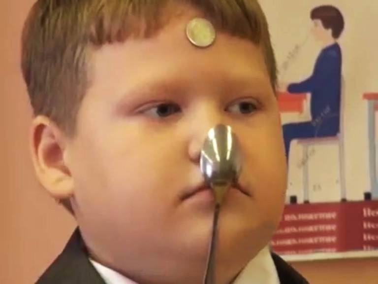 Cậu bé được ví như thanh nam châm sống