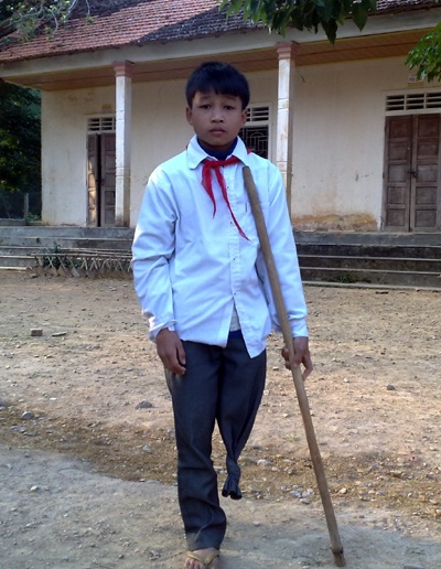 “Cháu chỉ muốn có một chiếc xe lăn” - 1