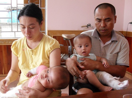 Nghẹn ngào trước cảnh cặp sinh đôi bị bệnh xương thủy tinh - 2 Nghẹn ngào trước cảnh cặp sinh đôi bị bệnh xương thủy tinh - 2